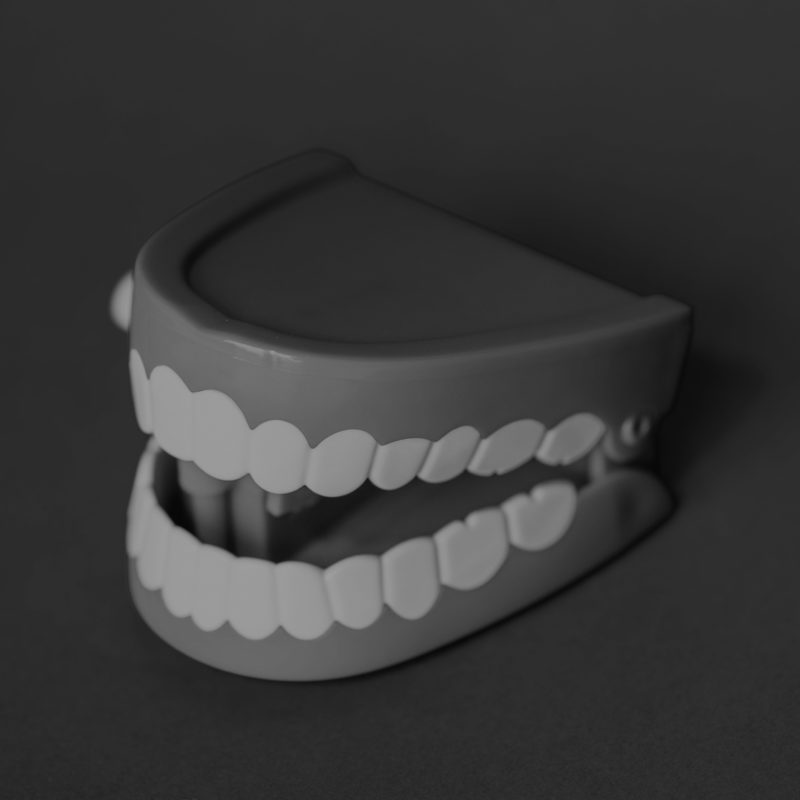 How much does a (dental) crown cost?
